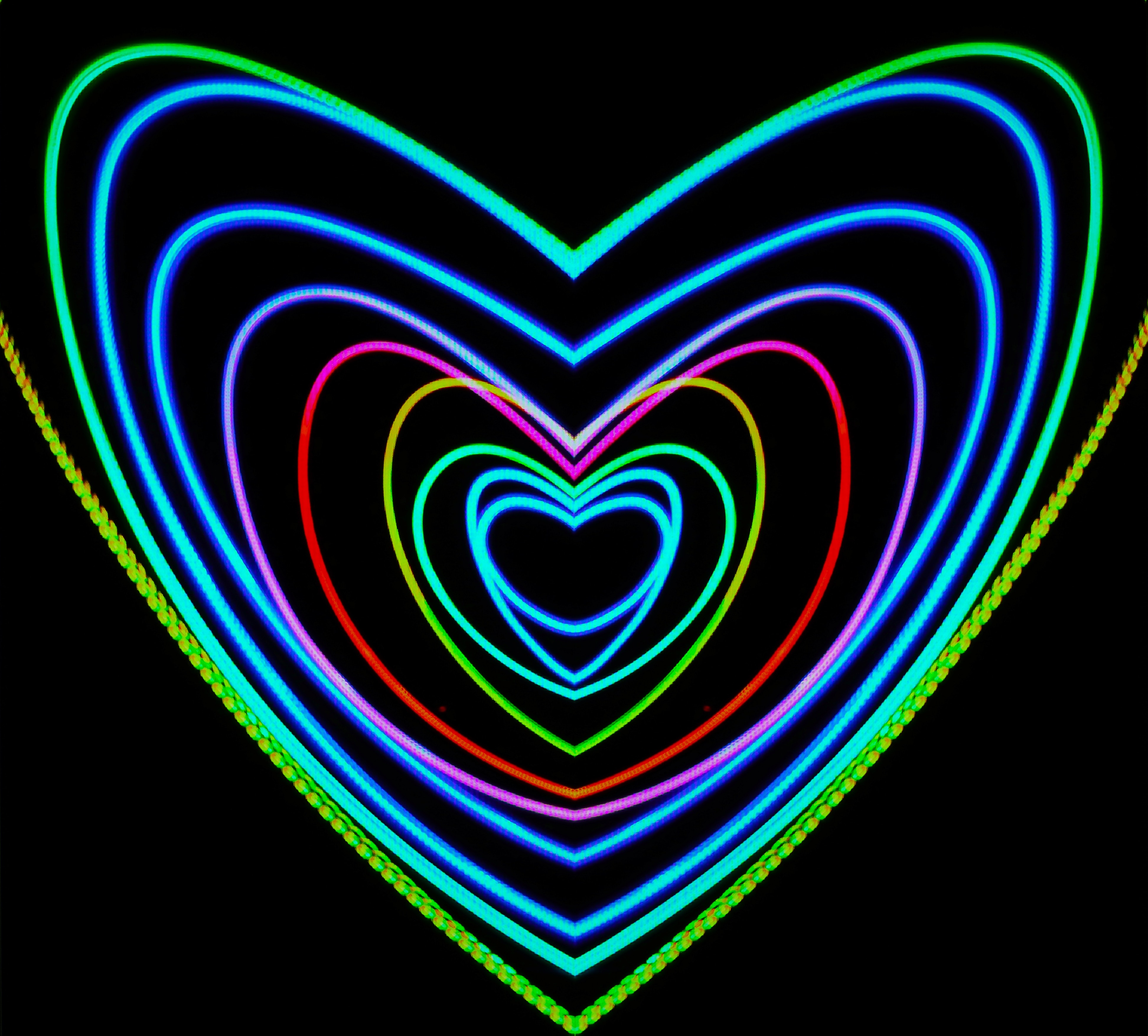 Accélérocardiogramme